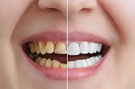 Cosmetic Procedures