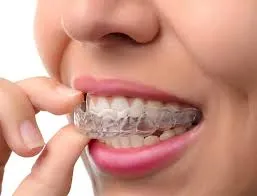 Mouth Guards
